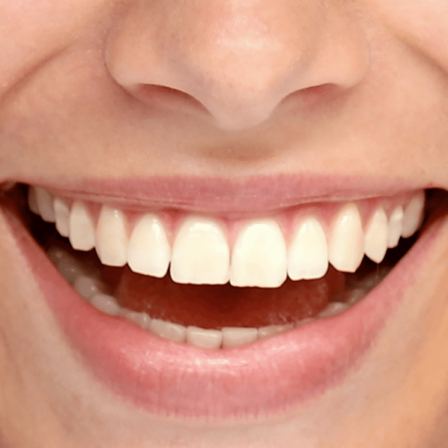 teeth grinding causes and treatments