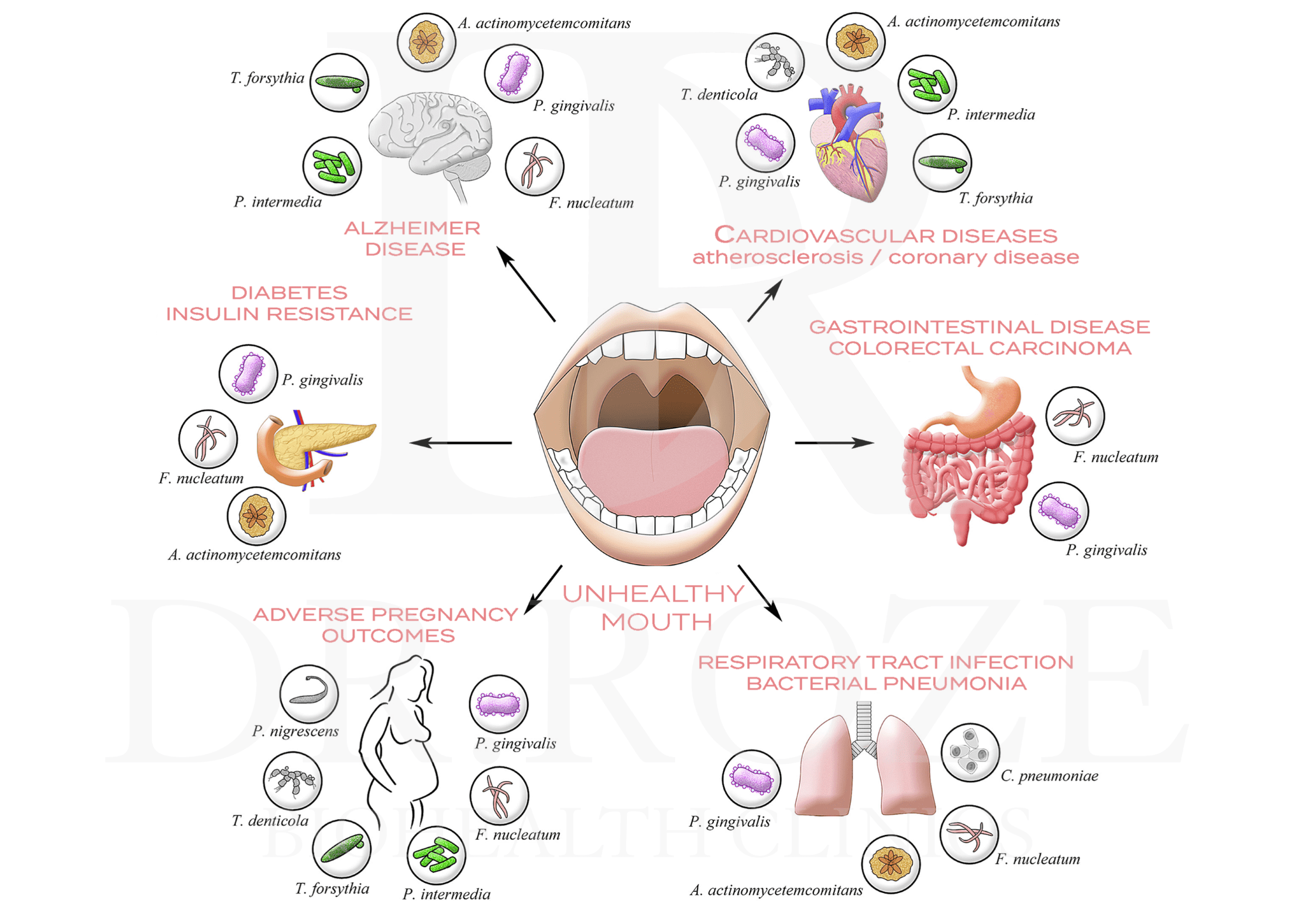 Periodontics