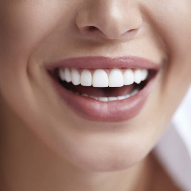 teeth whitening teeth whitening