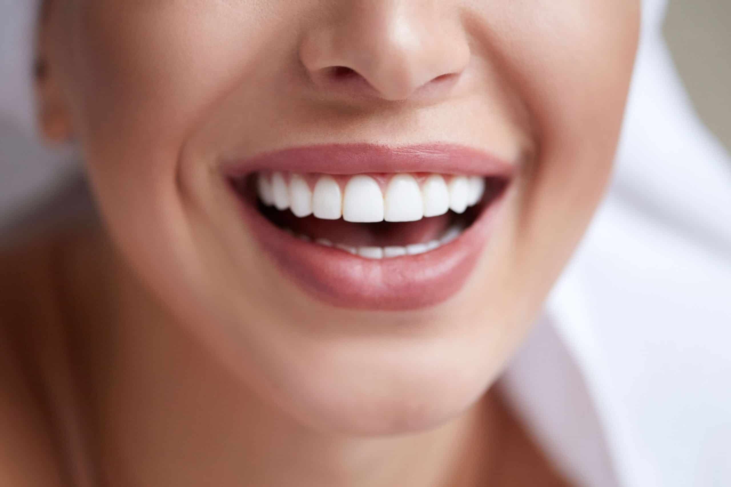 teeth_whitening_zoom