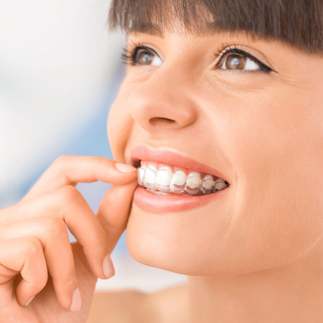 benefits of  Invisalign benefits of Invisalign