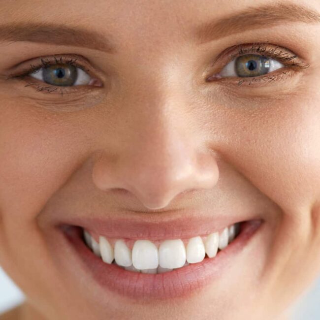 Permanent retainers: