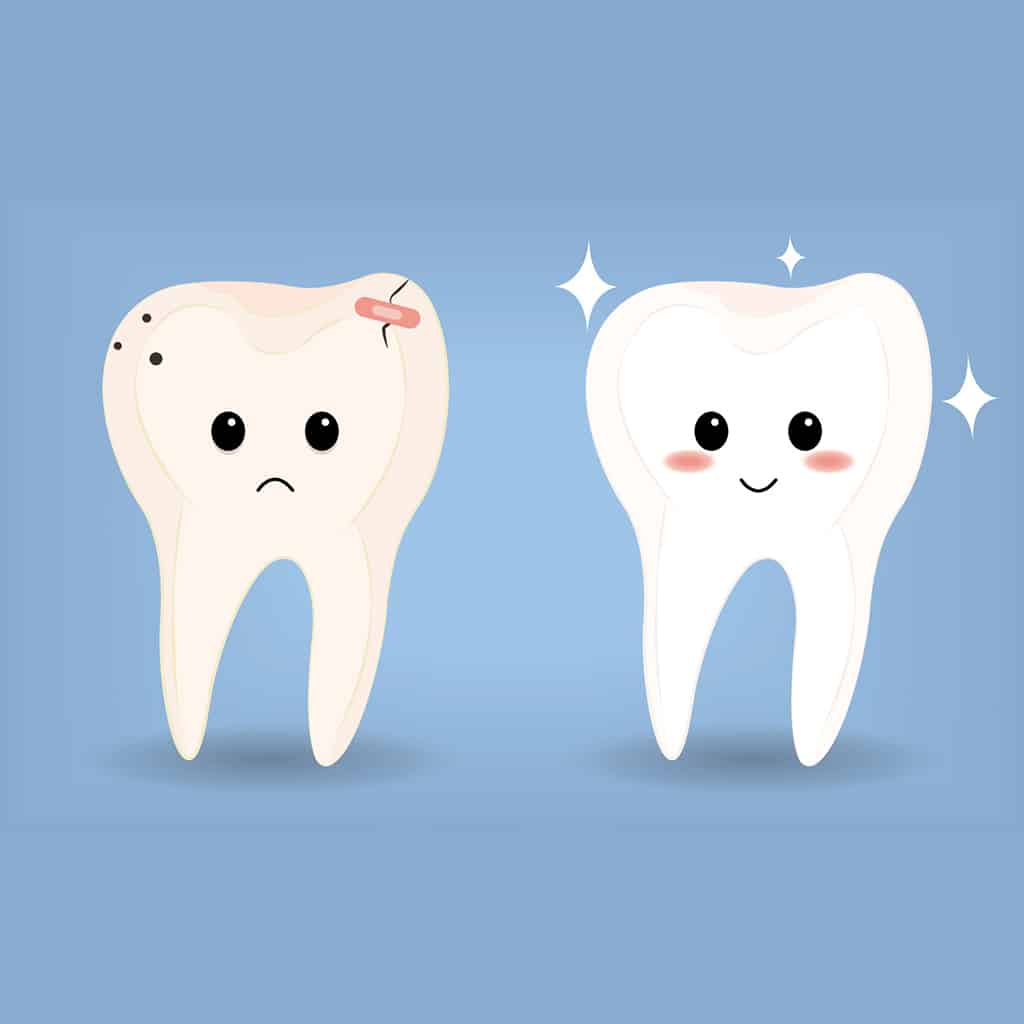 Dental Emergency Tooth Damage Repair Kit