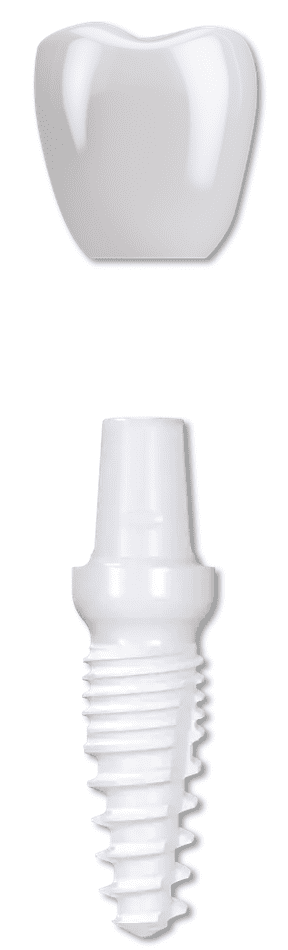 Monobloc Zirconium Implant 2005