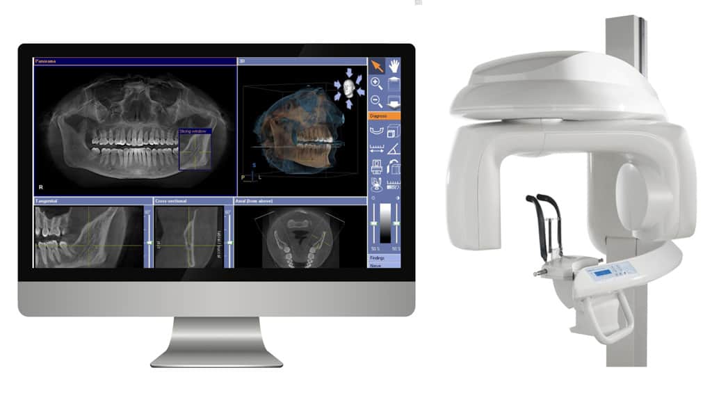 computer-guided implant surgery_3 computer-guided implant surgery_3