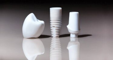 Ceramic dental implants near me