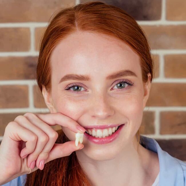 Wisdom Tooth Extraction Wisdom Tooth Extraction
