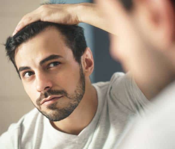 Hair_loss Hair Loss