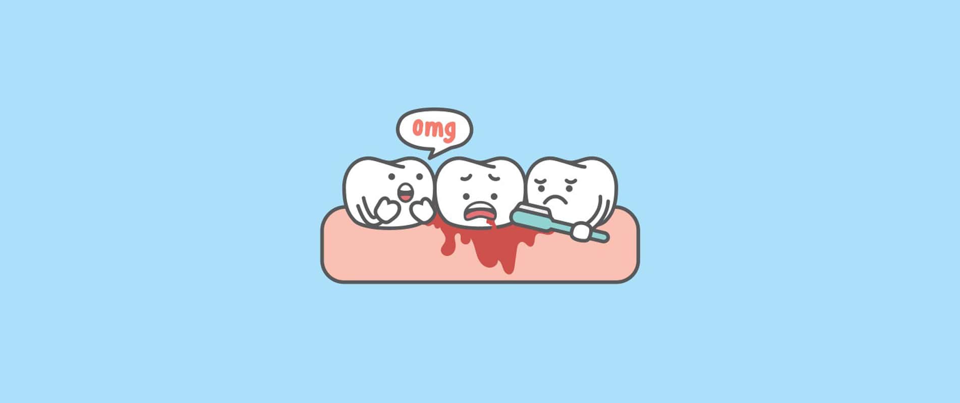 Bleeding Gums