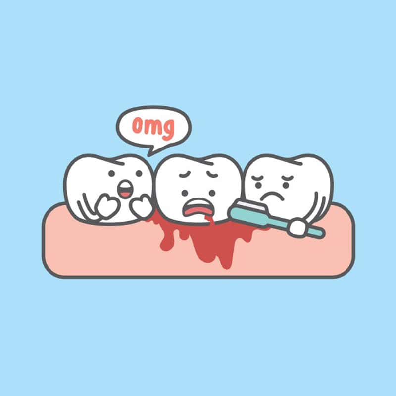 Bleeding Gums: Signs and When to Consult Your Dentist
