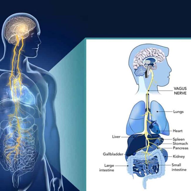 Vagus Nerve Stimulation