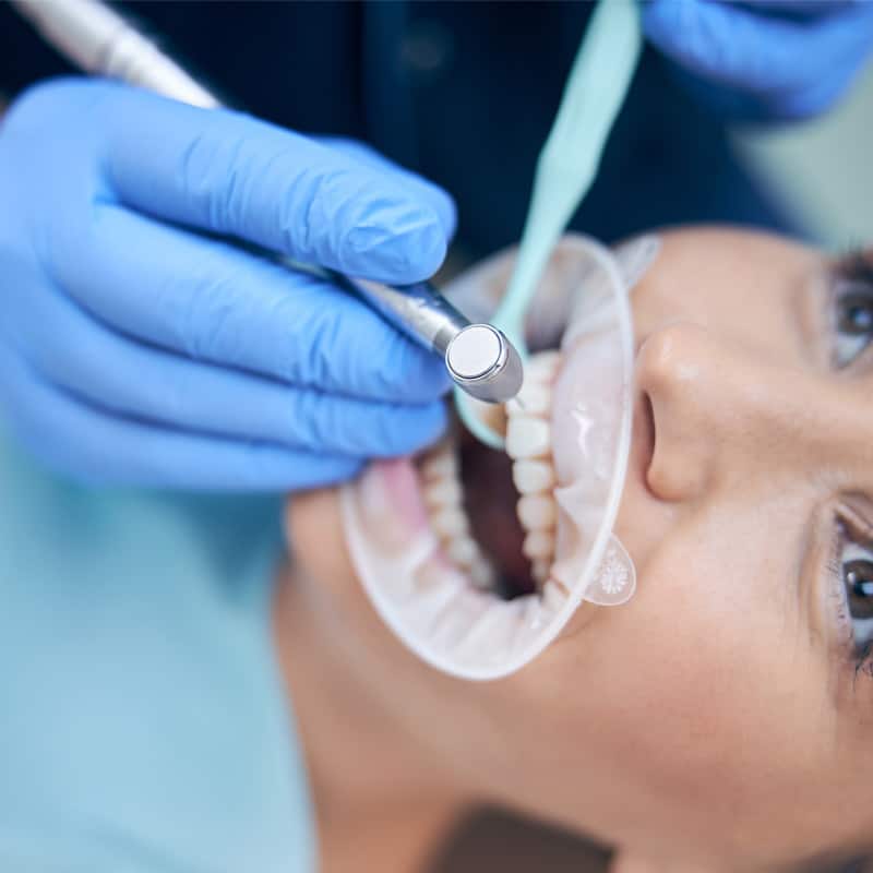 biological_teeth_cleaning_dubai biological_teeth_cleaning