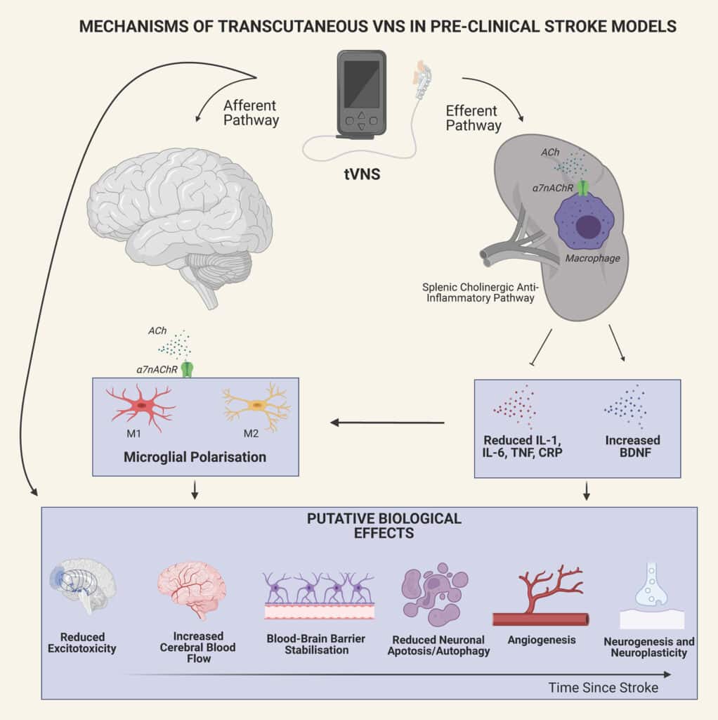 vagus_nurve_stimulation_1
