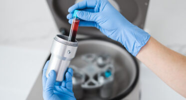 PRF_Biological_Dentistry