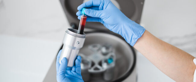 PRF_Biological_Dentistry PRF_Biological_Dentistry