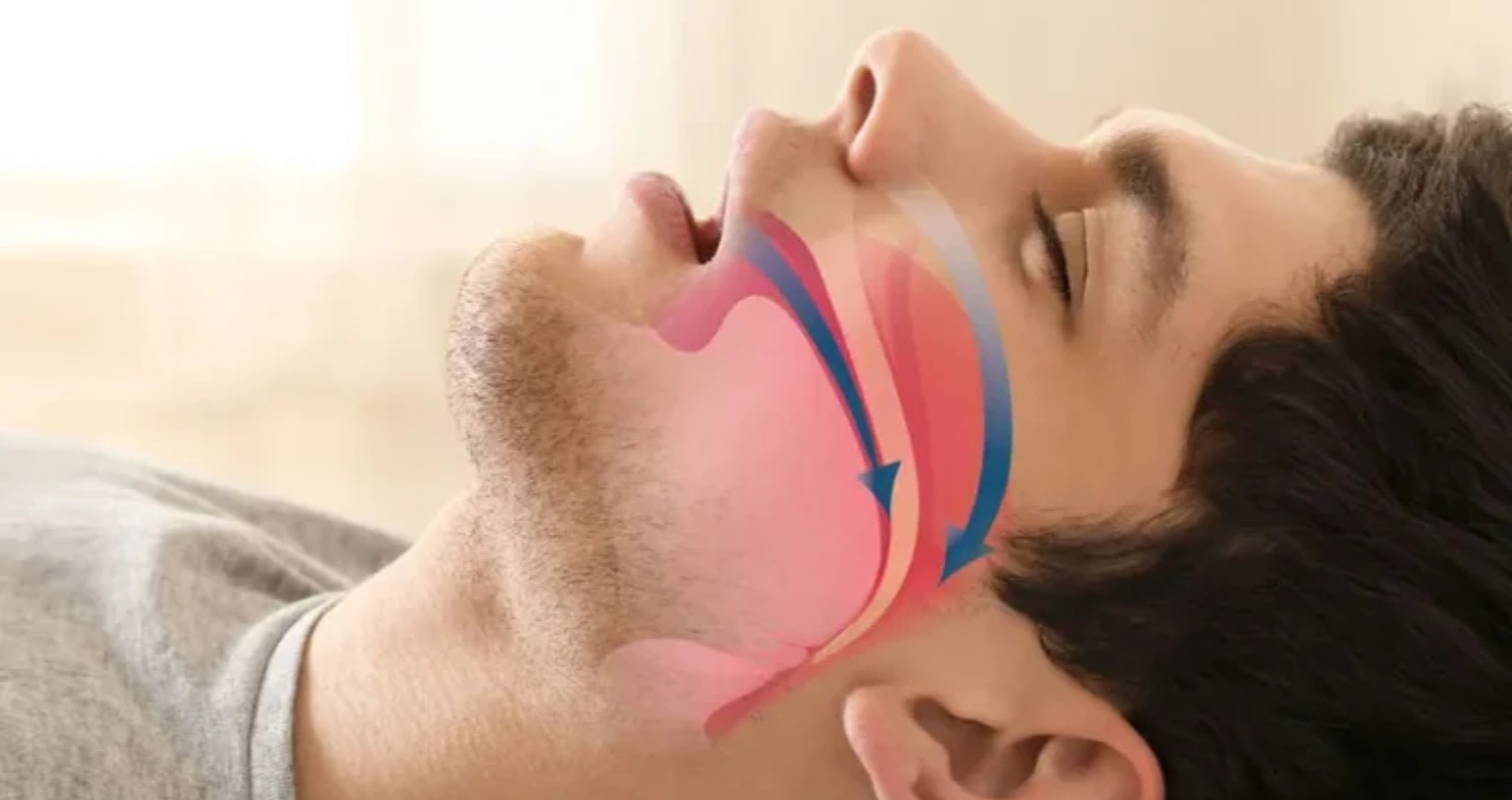 airway dentistry