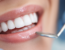 Dentist_dubai_ROZE_BioHealth
