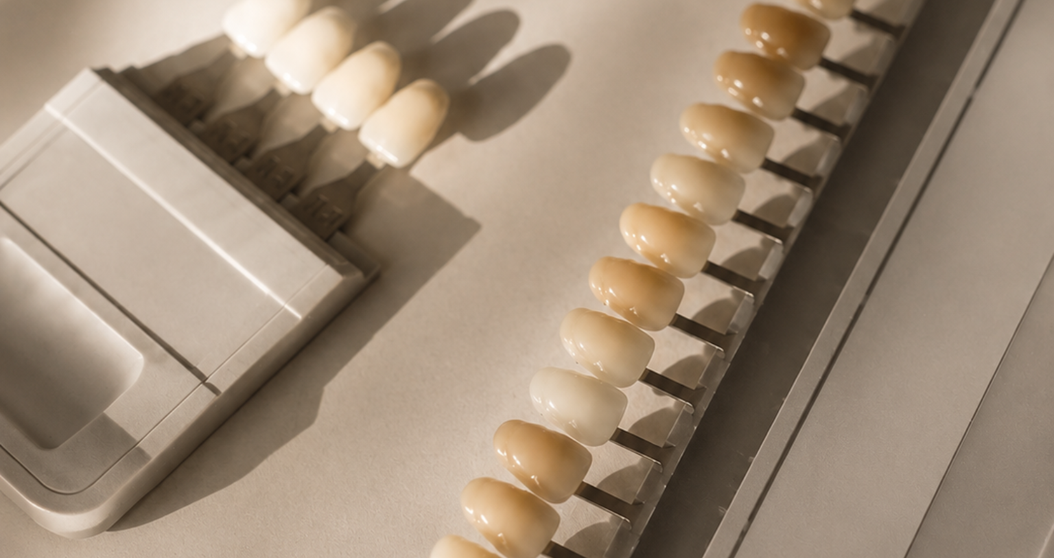 Feldspathic Veneers