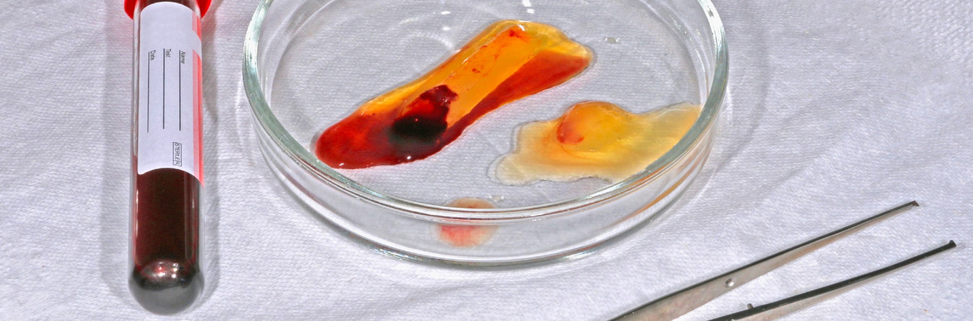 PRF_Dentistry_Dubai