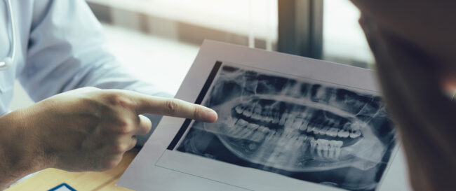 Regenerative Endodontics Protocol