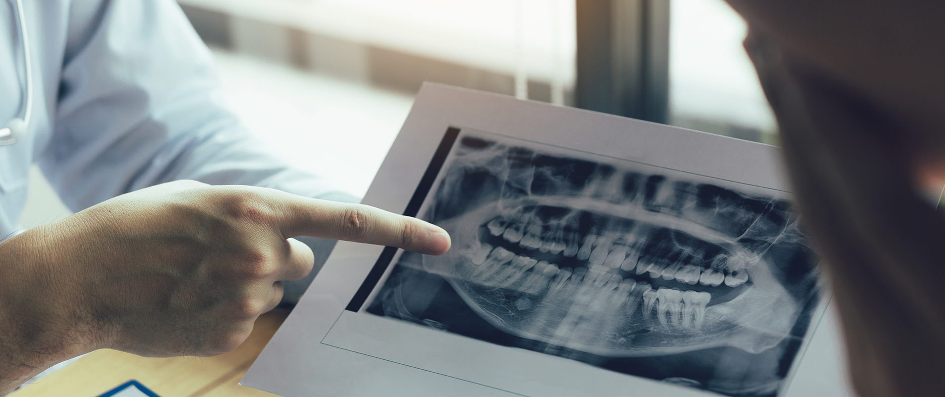 Regenerative Endodontics Protocol