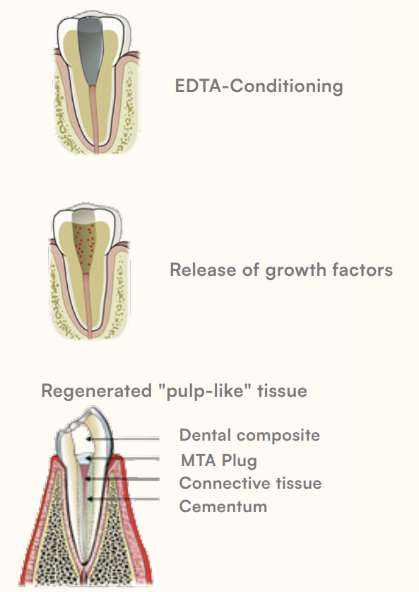 REP_how_its_works REP_how_its_works