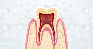 Regenerative_Endodontics _ Roze_BioHealth