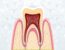 Regenerative_Endodontics _ Roze_BioHealth