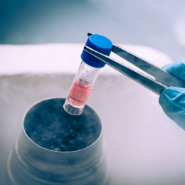 Stem Cell Collection