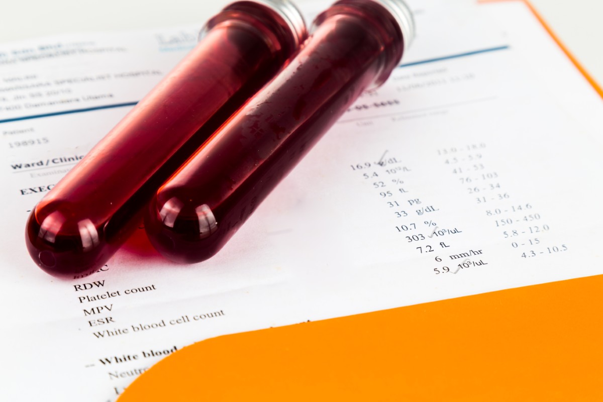 Blood sample in test tubes with health analysis screening report